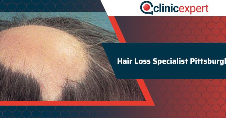 Hair Loss Specialist Pittsburgh