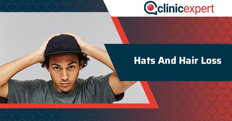 Hats And Hair Loss