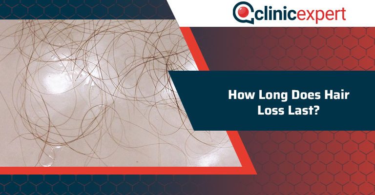 How Long Does Hair Loss Last?