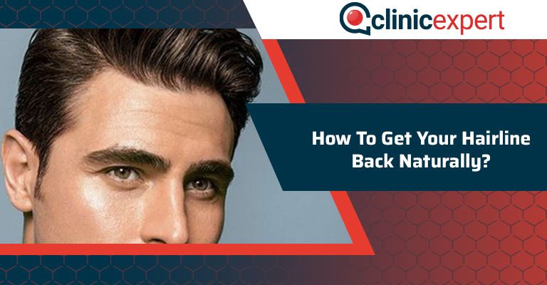 How To Get Your Hairline Back Naturally?