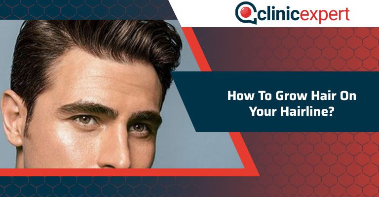 How To Grow Hair On Your Hairline