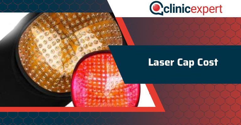 Laser Cap Cost