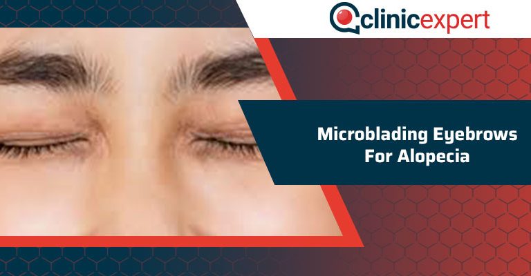 Microblading Eyebrows For Alopecia