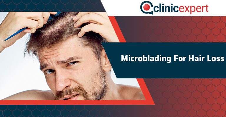 Microblading For Hair Loss