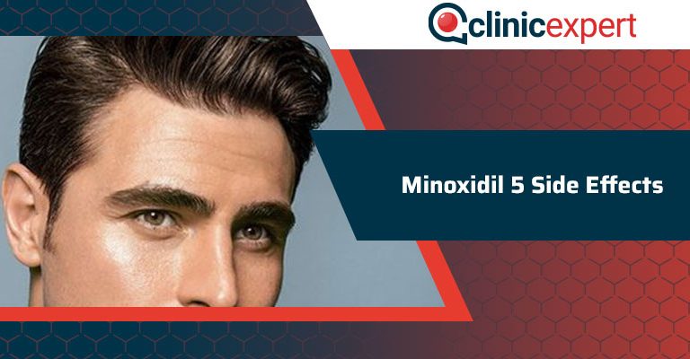 Minoxidil 5 Side Effects