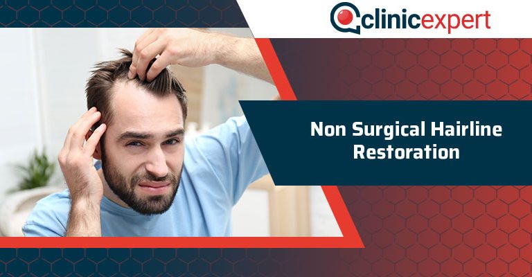 Non Surgical Hairline Restoration