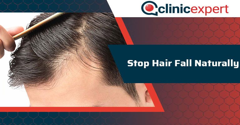 Stop Hair Fall Naturally