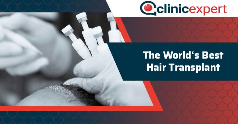 The World's Best Hair Transplant