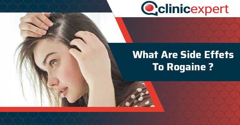 What Are The Side Effects To Rogaine?