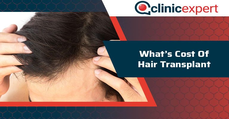 Hair Transplant Cost In Turkey