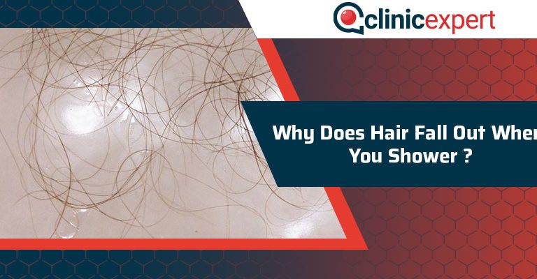 Why Does Hair Fall Out When You Shower?