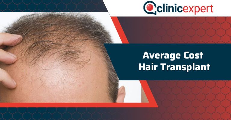 Average Cost Hair Transplant hair transplant cost turkey