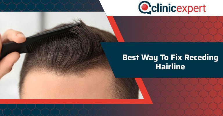 Best Way To Fix Receding Hairline