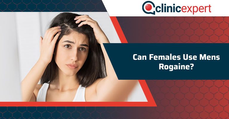 Can Females Use Men's Rogaine?