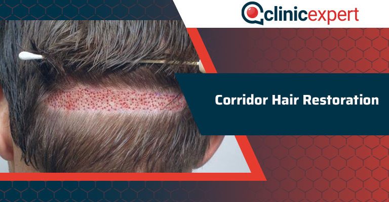 Corridor Hair Restoration 