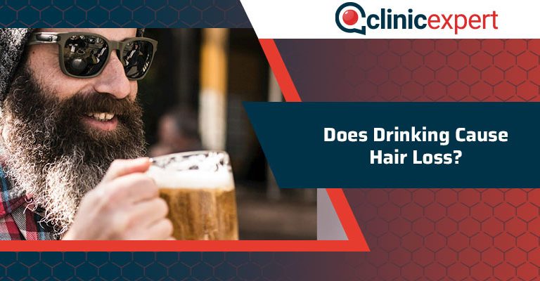 Does Drinking Cause Hair Loss?