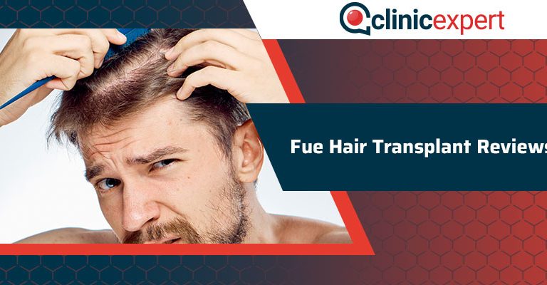 Fue Hair Transplant Reviews