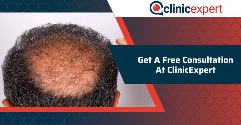 Get A Free Hair Consultation At ClinicExpert