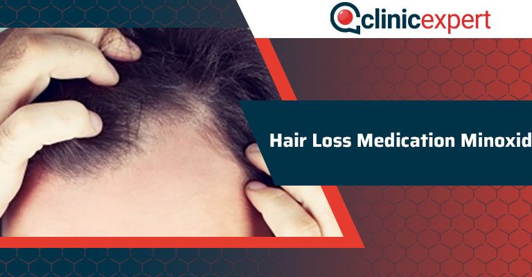 Hair Loss Medication Minoxidil