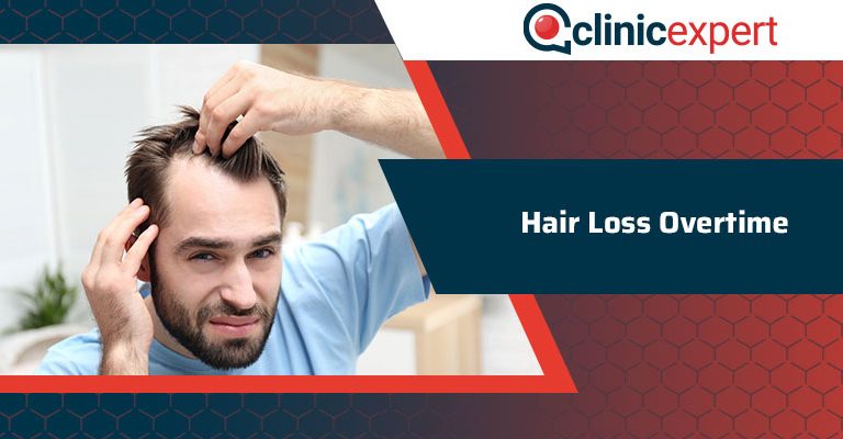 Hair Loss Overtime