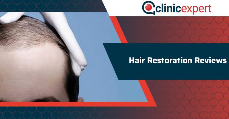 Hair Restoration Reviews