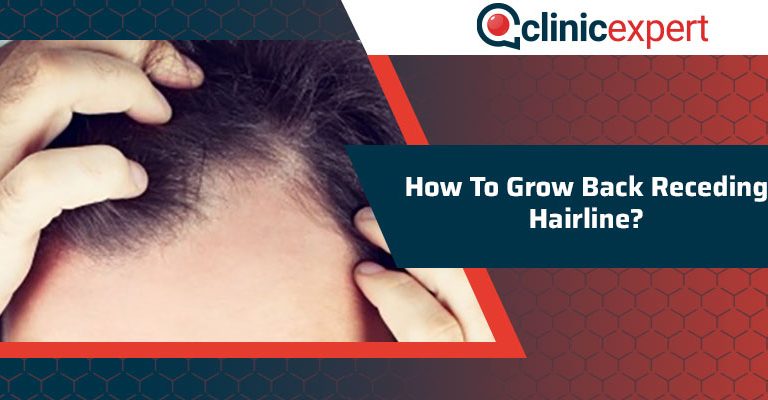 How To Grow Back Receding Hairline? 