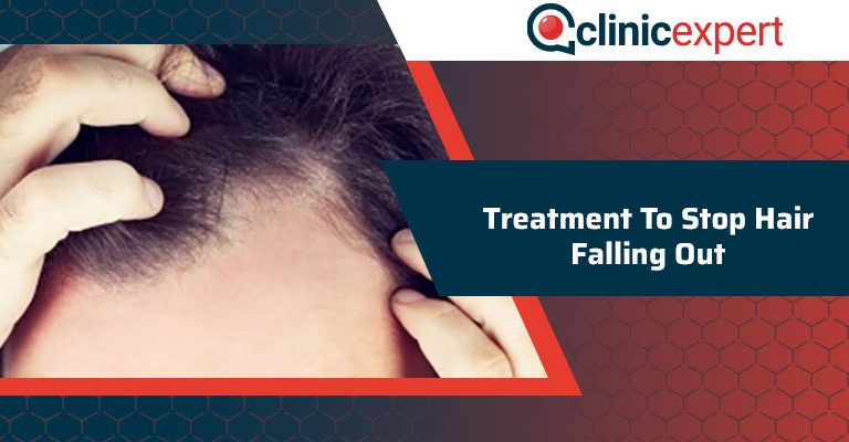 Treatment To Stop Hair Falling Out 