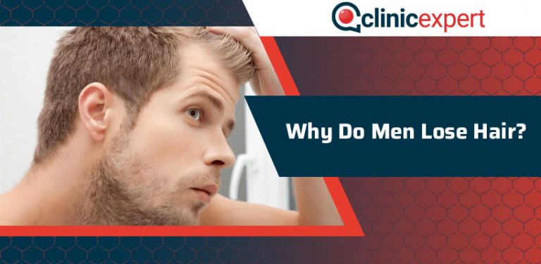 why-do-men-lose-hair-clinicexpert