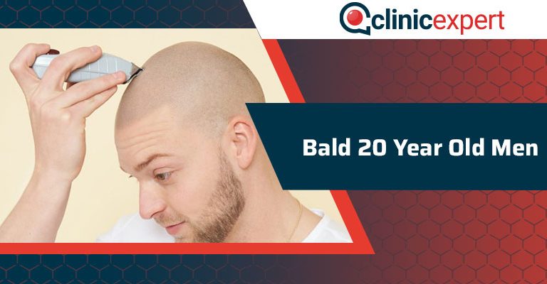 Bald 20 Year Old Men