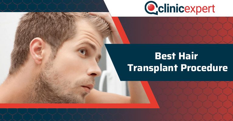 Best Hair Transplant Procedure