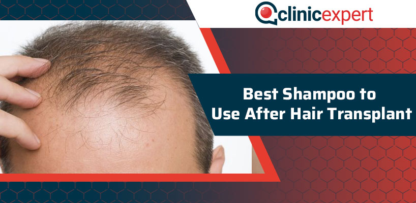hair transplant Man loses life after botched hair transplant treatment   The Economic Times