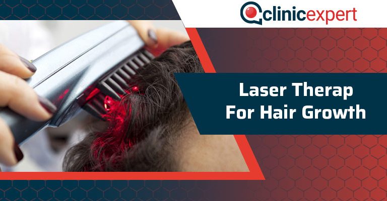 Laser Therapy for Hair Growth