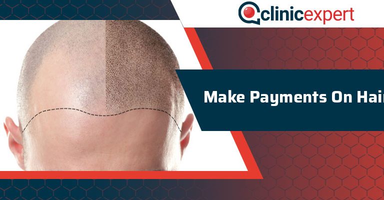 Make Payments On Hair