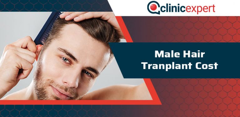 Male Hair Transplant Cost Hair Transplant Clinicexpert 2730