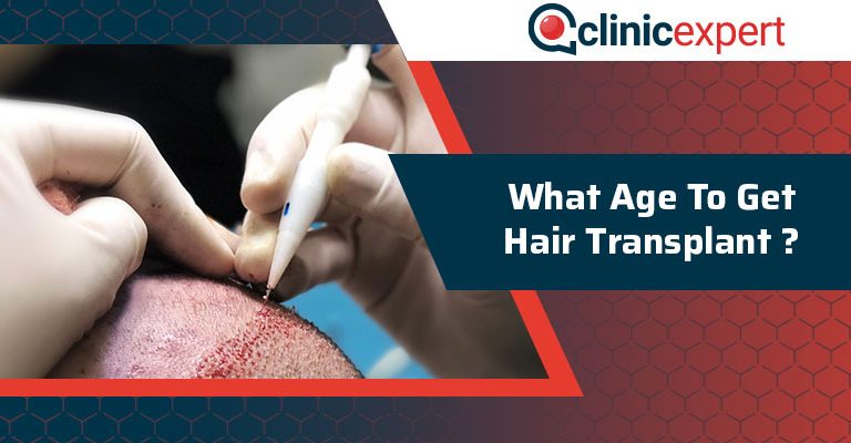 What Age To Get Hair Transplant?