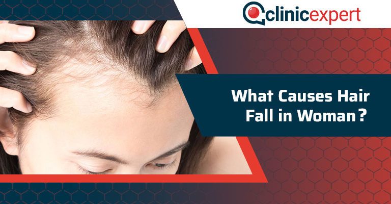 What Causes Hair Fall in Woman?