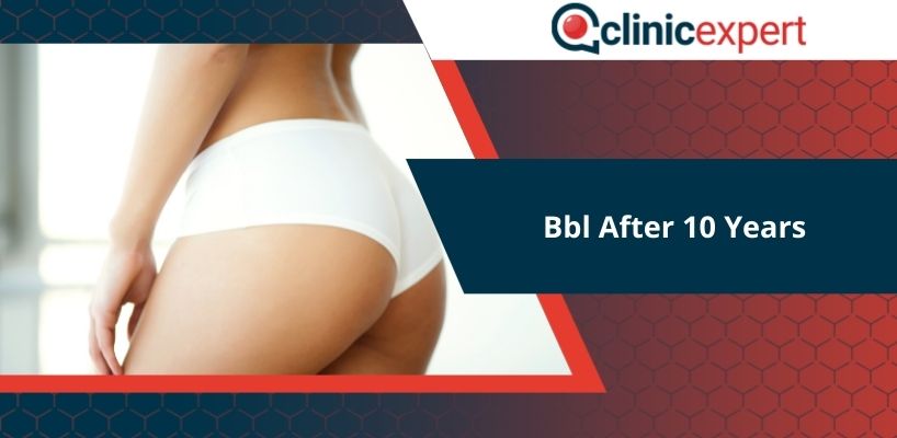 Is a bbl body permanent? BBL Long Term Results