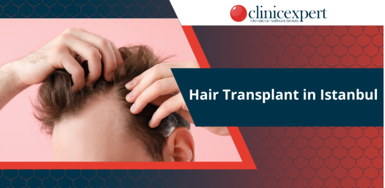 Hair Transplant In Istanbul Clinicexpert 7337