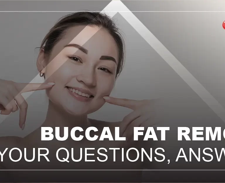 BUCCAL FAT REMOVAL All Your Questions, Answered