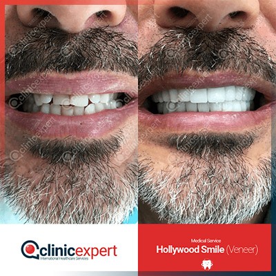 Clinic Expert Aesthetic