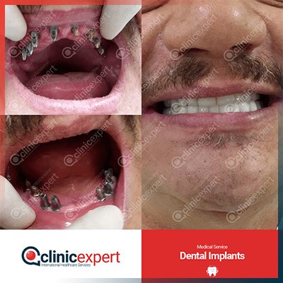 Clinic Expert Aesthetic