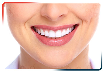 Embellissement des Dents