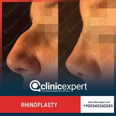 Clinic Expert Aesthetic