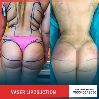 Clinic Expert Aesthetic