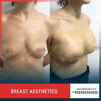 Clinic Expert Aesthetic