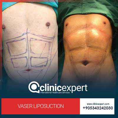 Clinic Expert Aesthetic