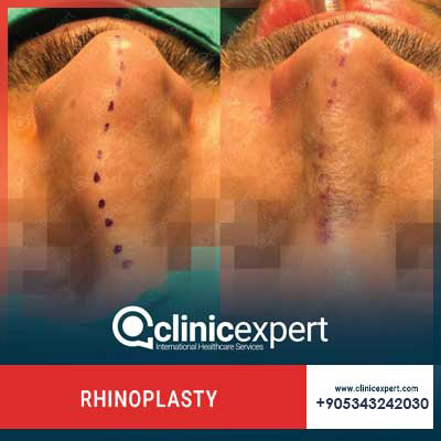 Clinic Expert Aesthetic