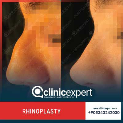 Clinic Expert Aesthetic