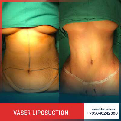 Clinic Expert Aesthetic