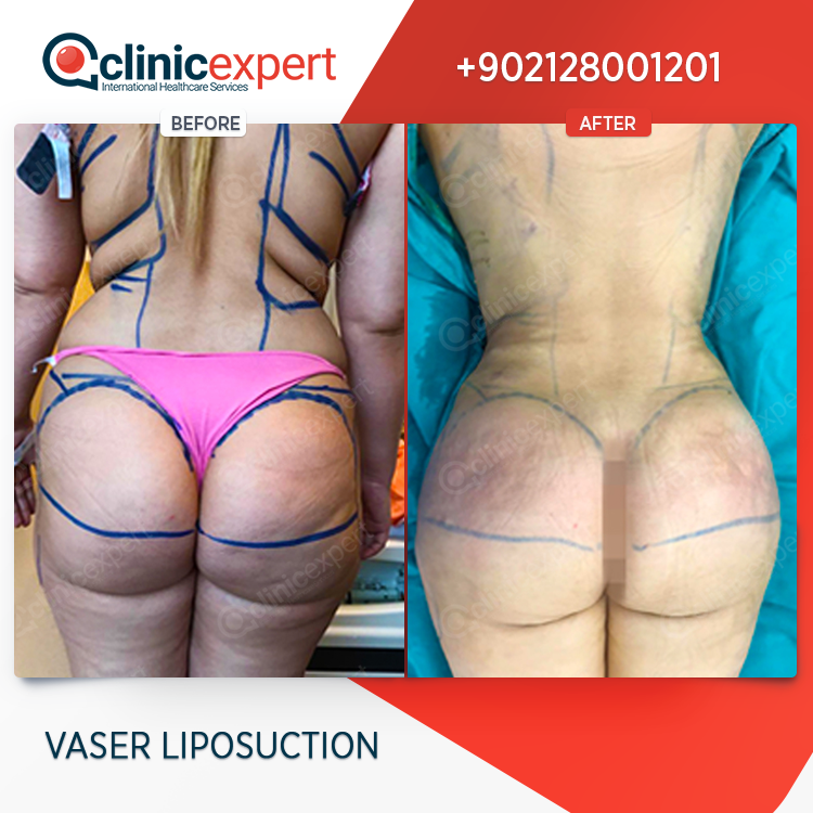 Clinic Expert Aesthetic